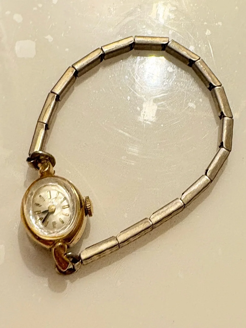 Timex it needs
